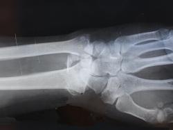 Nano-X Imaging Aktie: Was passiert mit der Nano-X Imaging Aktie?